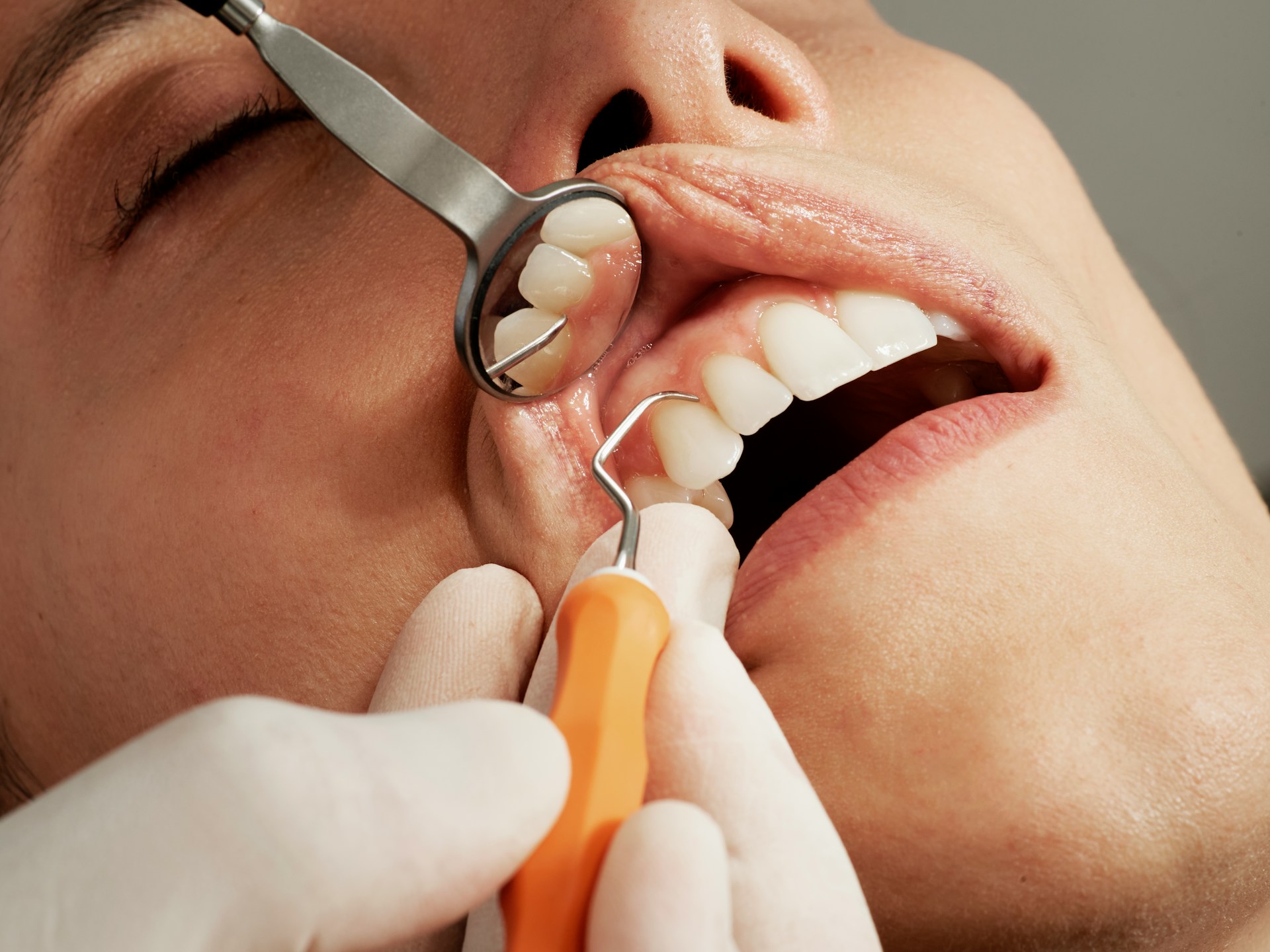Serious oral health deficiencies among young people in special residential homes for young people